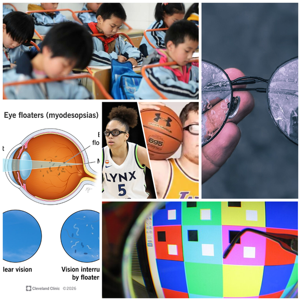 Myopia - Taking it Seriously